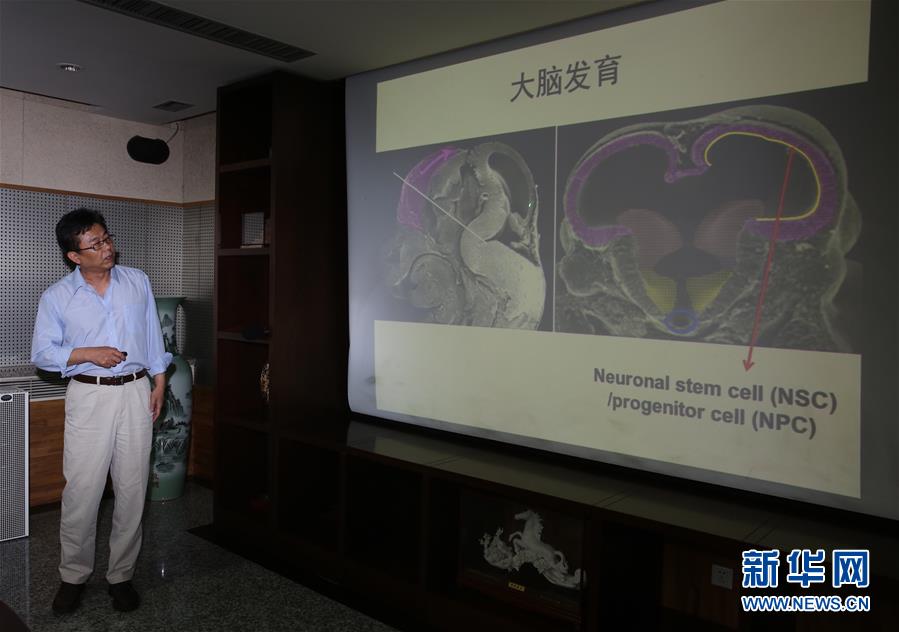 Cientistas chineses conformam liga??o entre Zika e microcefalia