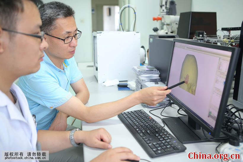 Cirurgia cerebral com tecnologia de impress?o 3D é realizada em Shandong