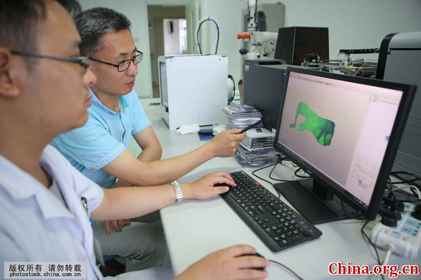 Cirurgia cerebral com tecnologia de impress?o 3D é realizada em Shandong