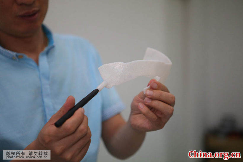 Cirurgia cerebral com tecnologia de impress?o 3D é realizada em Shandong