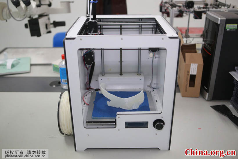 Cirurgia cerebral com tecnologia de impress?o 3D é realizada em Shandong