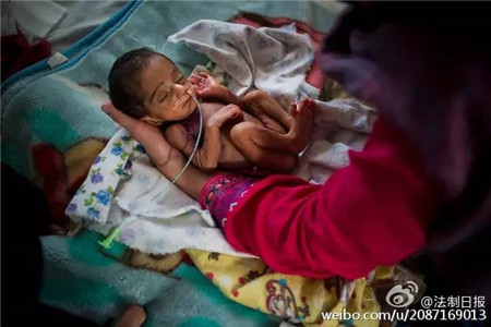 Obstetra chinesa trabalha como voluntária no Médicos Sem Fronteiras