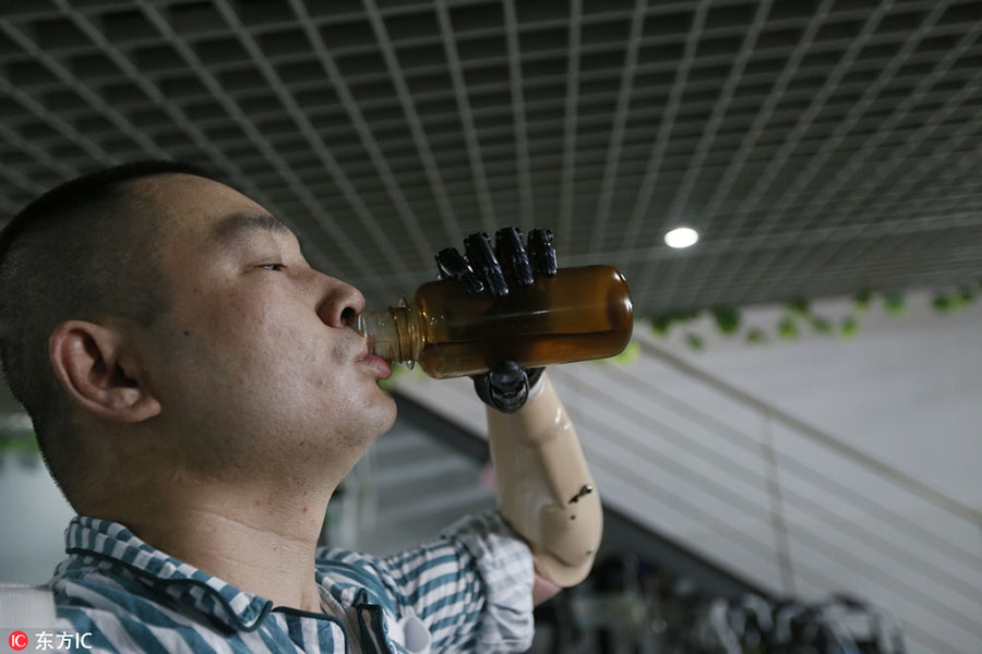 Instalado primeiro bra?o biónico inteligente em Guangdong