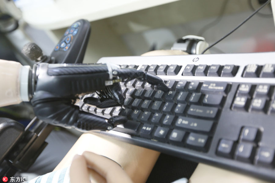 Instalado primeiro bra?o biónico inteligente em Guangdong