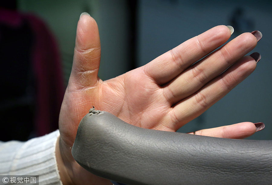 Chinesa com perna amputada consegue rendimentos elevados através do seu trabalho