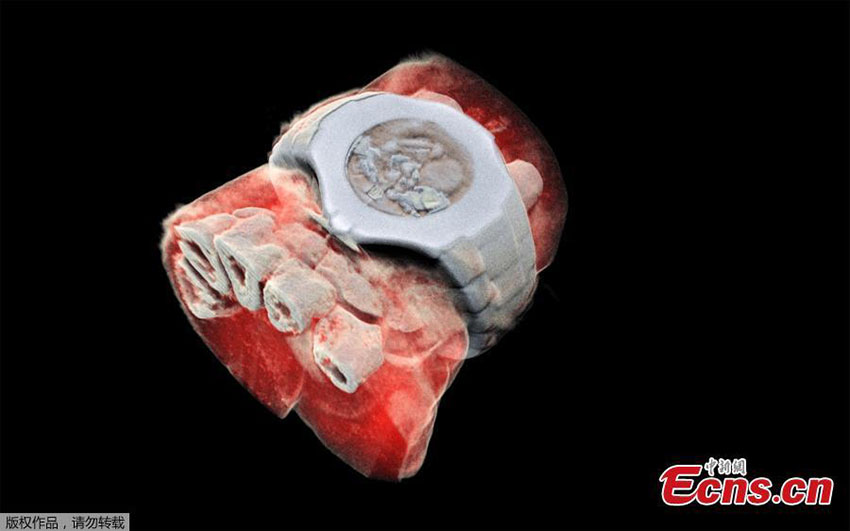 Cientistas neozelandeses realizam primeiro raio x a cores num ser humano